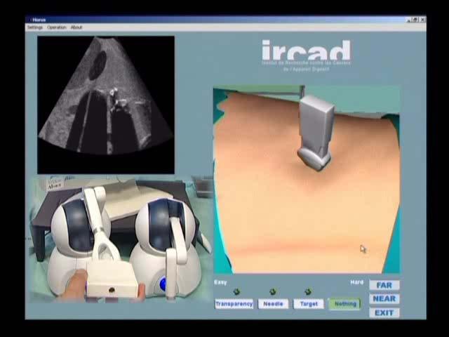 HORUS : Ultrasonography simulator