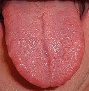 are taste buds, located in papillae