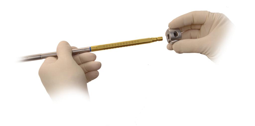8 Zimmer Natural Nail System Cephalomedullary Nail Technique - Small Select the appropriate length LAG SCREW based on previous measurements.