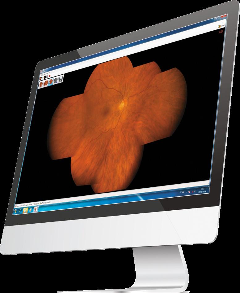 This flexible and user-friendly non-mydriatic retinal camera can be adapted to all types of practice set-up and will ensure the comfort of your patients.