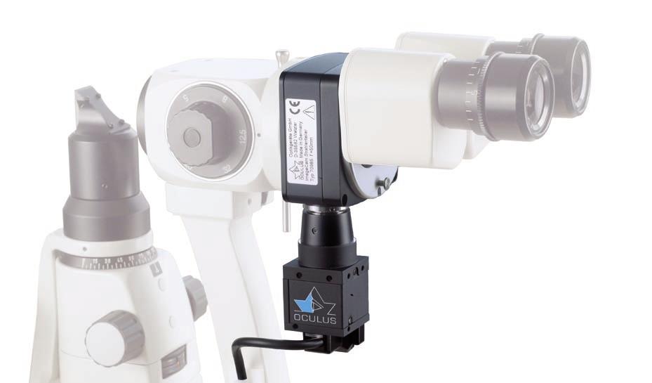 OCULUS ImageCam 2 Slit lamp documentation at its best Versatile applications The OCULUS ImageCam 2 can easily document the results of your slit lamp examinations with high quality pictures and videos.