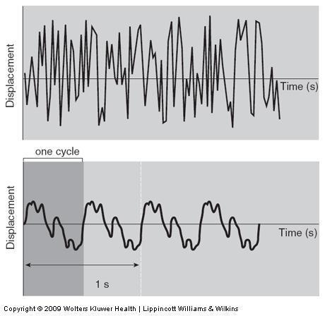 Complex waveforms Aperiodic vibration does not have a repeating pattern in time