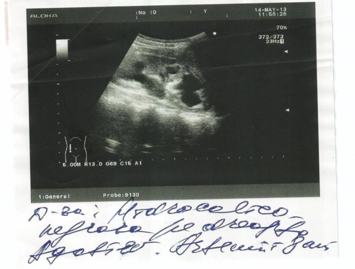 Ultrasonografia organelor interne (ficatul: lob drept 108mm, lob stâng 41mm, vena portă 7mm, omogen cu ecogenitate medie; vezica biliară 5926mm, cu infleiune la gât; pancreasul 101011mm, omogen cu