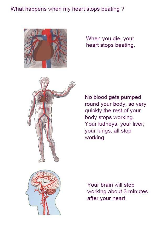 Your kidneys, your liver, your lungs all stop working. Your brain will stop working about three minutes after your heart stops beating.