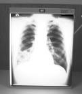 Figure1: Select radiograph Background Background for the use of digitizing images in the hospital follows.