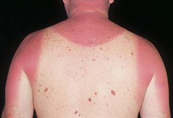 c) UV rays and X rays can damage your body, but you cannot see them doing the damage.