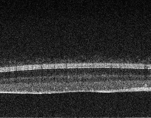 4(e) has been vertically cropped to show only the relevant depths containing retinal tissue data.