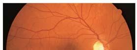 2 Eyes That See Light The retina: Optics are similar