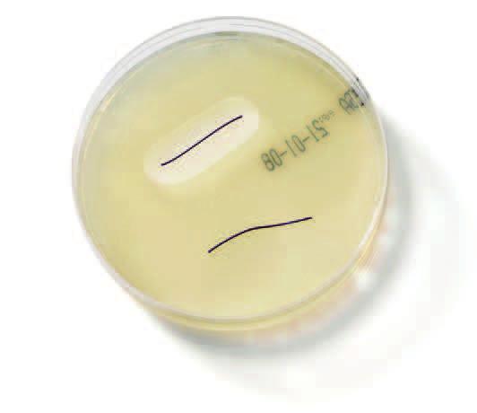 Plus Antibacterial Sutures ETHICON developed VICRYL* Plus, MONOCRYL* Plus and PDS* Plus Surgical Site Infections (SSIs).