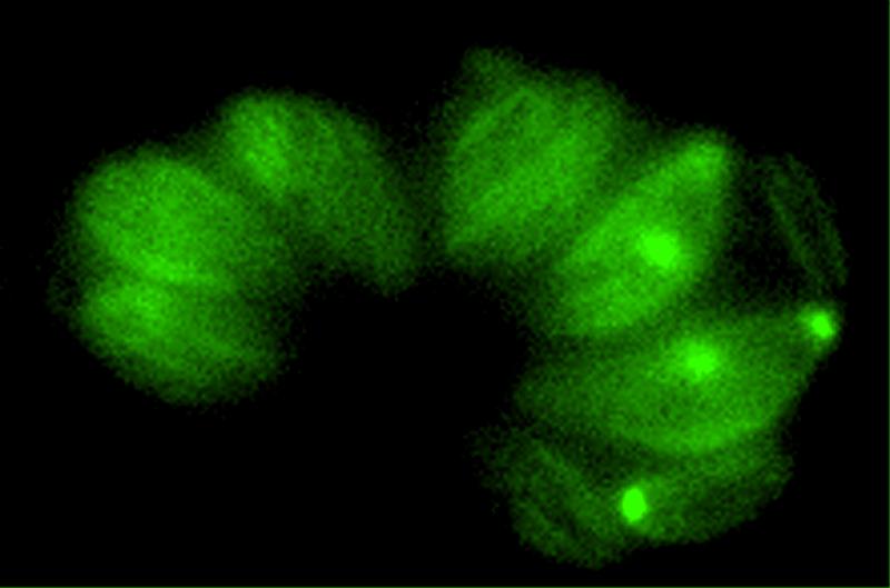 Microtubules in Toxoplasma