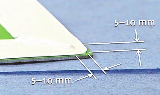 Apply light pressure to the overlap, ensuring both edges of the tape are properly sealed (Figure 16). c.