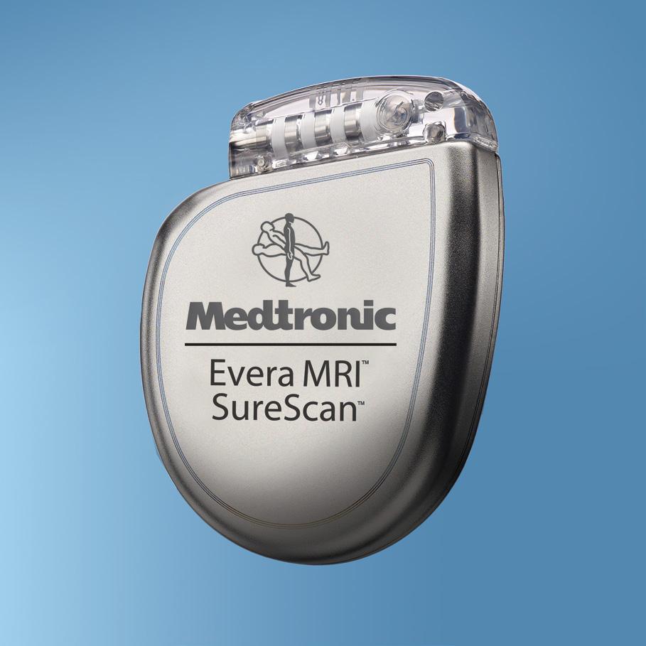NOW WITH MRI ACCESS TRUE BIPOLAR PACING AND SENSING Sprint Quattro leads have true bipolar pacing and sensing.