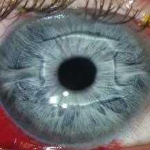Generations of leading ophthalmologists have played a key role in perfecting this unique examination tool.