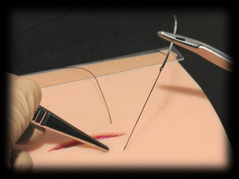 Grasp the near edge of the incision with the forceps close to the place where the needle is to enter.
