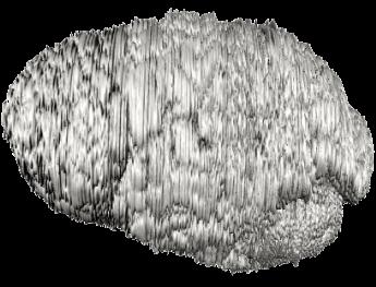 High-Resolution Brain Models from