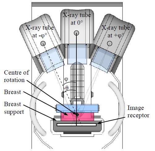 Digital Breast Tomosynthesis Scan: N projections New variable affecting IQ o tube/detector/patient motion o range of rotation o number of projections