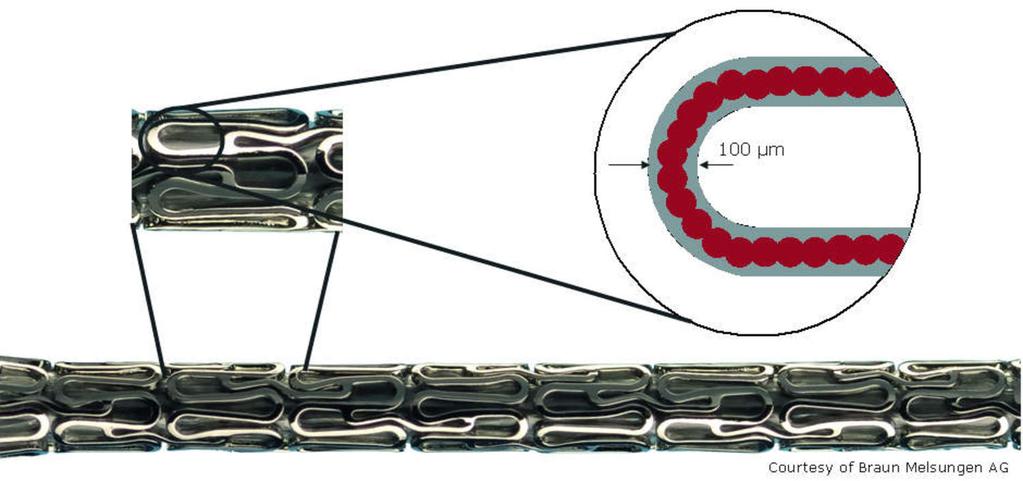 Seite/Page: 5 Figure 3: Drug diluting stent; only the outer surface needs to be coated (see