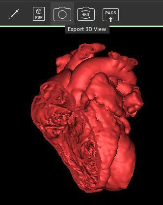 Release notes 11/2017 L-10740 Revision 3 For Mimics inprint 3.0 10 6 DICOM screenshot 6.1. Export 3D view Via Export 3D View a screenshot can be taken of the current 3D view with the visible object(s).