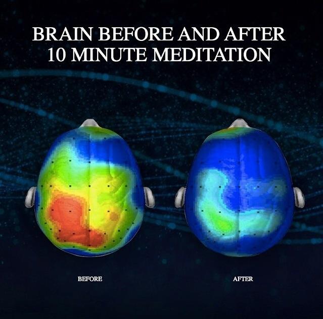 Meditation is to the brain is what aerobic exercise is