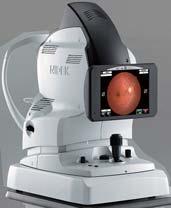 These smart features make fundus photography easier for screening and diagnosis.