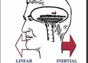b. Change in Gravity When the head is tilted, the weight of the otoconia of the saccule pulls the cupula, which in turn bends the hairs that send a signal to the brain indicating that the head has