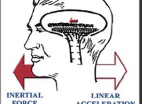 1 VESTIBULAR ILLUSIONS: (SOMATOGRAVIC - Utricle and Saccule) Illusions involving the utricle and the saccule of the vestibular system are most likely under conditions of unreliable or unavailable