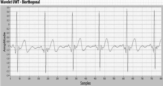 . Figure 7 ECG signal applying Daubechies UWT filter Figure 4 ECG signal applying a high pass Kaiser