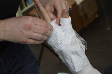 Starting below the stockinette and foam padding place the material around the thumb area and ensure a good fit at the distal end of the cast.