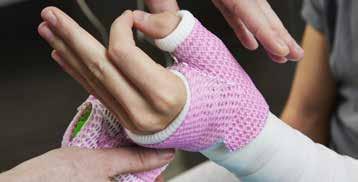Starting below the stockinette and foam padding place the material around the thumb area and take