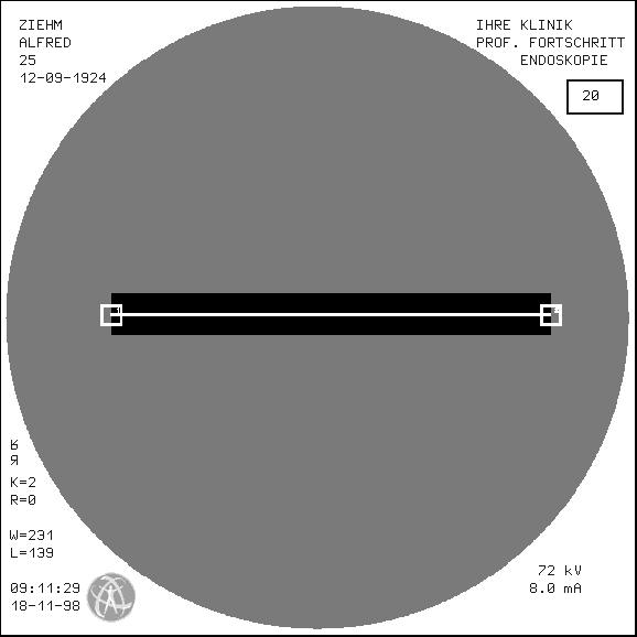 11 Post-Processing Images Move the marker square with the arrow keys pixel by pixel until you reach the first measuring point on the reference object (e.g. the first radiopaque marker on a balloon catheter).