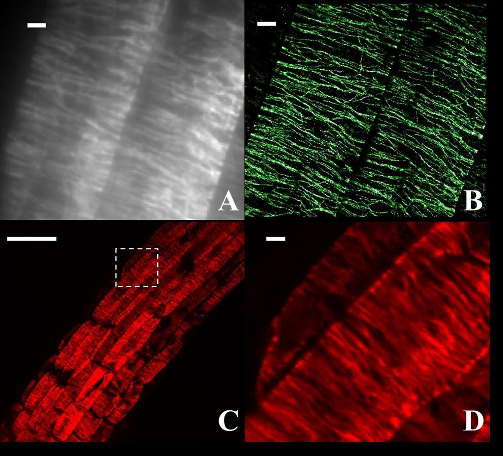 Supplemental Figure 4. Diffraction unlimited resolution in VAEM-STORM imaging compared to diffraction limited imaging of cortical microtubules in plant cells in the elongation zone.