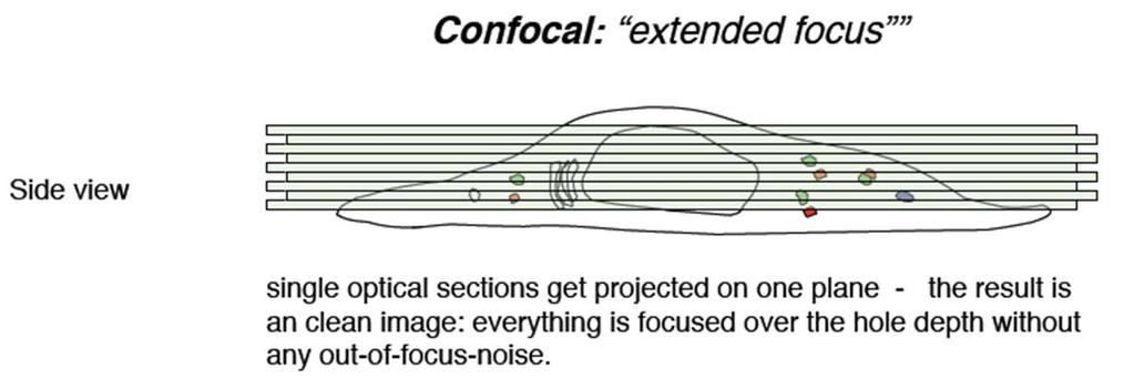 Confocal laser