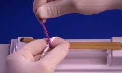 polypropylene suture. The surgeon's knot also may be performed using a one-hand technique in a manner analogous to that illustrated for the square knot one-hand technique.