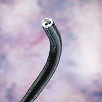 Images are brought to life with a unique 100x optical magnification feature easily operated from the control head of the endoscope.