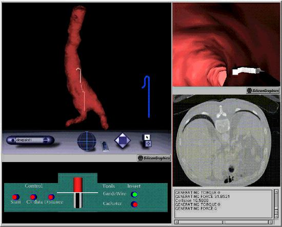 Vascular Surgery Interventional radiology is another complex area where web-based virtual reality has the potential to become an important training aid.
