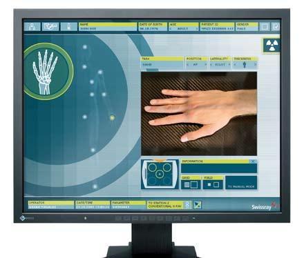 Patient Data Management Connecting seamlessly The expert control desk automates every aspect of the radiographic procedure.