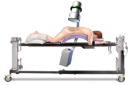 VIPER Surgical Technique OR Set-Up The patient should be positioned prone lying flat on a radiolucent table.