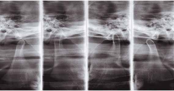 6 x constant The X-ray image is enlarged by a factor of 1.6 the best prerequisite for an even better diagnosis.