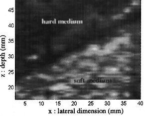 Strain Elastography Elastography: a method in which stiffness or strain images of soft tissues are measured and used to detect or classify hard parts of