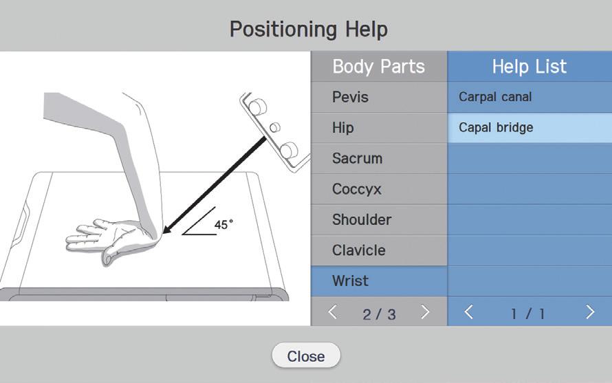 positioning image guides on the Tube Head Unit(THU) to ensure correct patient positioning
