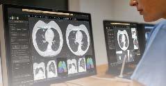 Radiation Therapy (Imaging to
