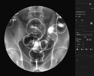 The system's design reflects our consideration of how to match all related aspects, such as ease of use, reduced X-ray dose, and observation using high-quality images, with the actual examination