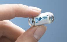 PillCam ESO, GivenImaging Developed in 2004 Two cameras; opposite ends of pill Similar weight and dimensions as PillCam SB 18 images per
