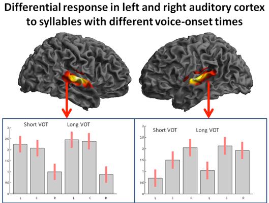 Medical Imaging PCS study (1 of 7): Information integration, transcallosal communication, and inter-individual variability during the processing of voiced and unvoiced consonants in speech signals