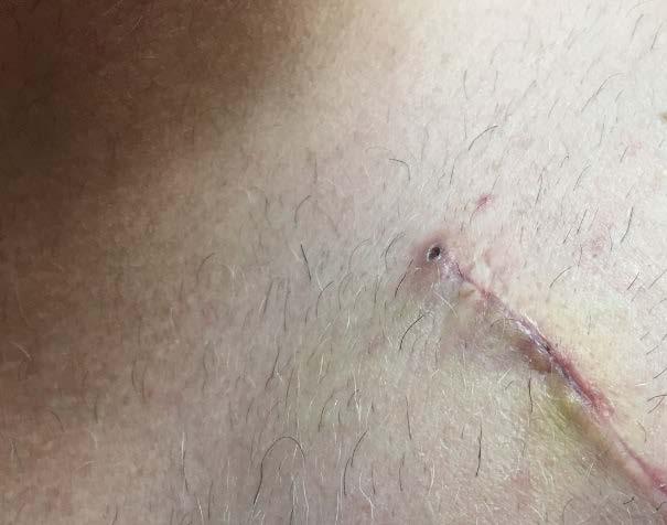 below, the wound and the area around the