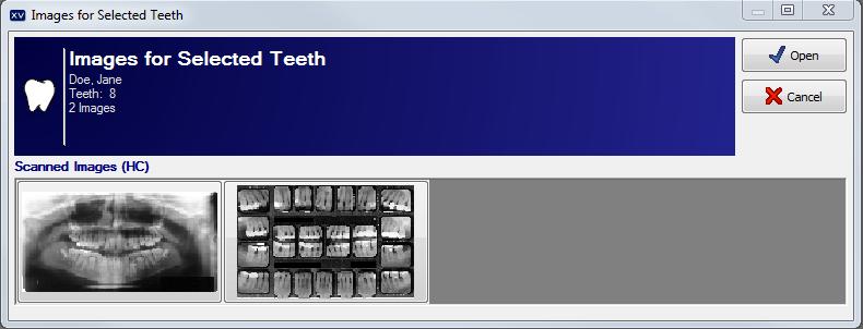 If desired, right-click to switch the tooth control to display either adult or deciduous tooth numberings. 3. To view images, click on a tooth number to view all images related to that tooth. 4.