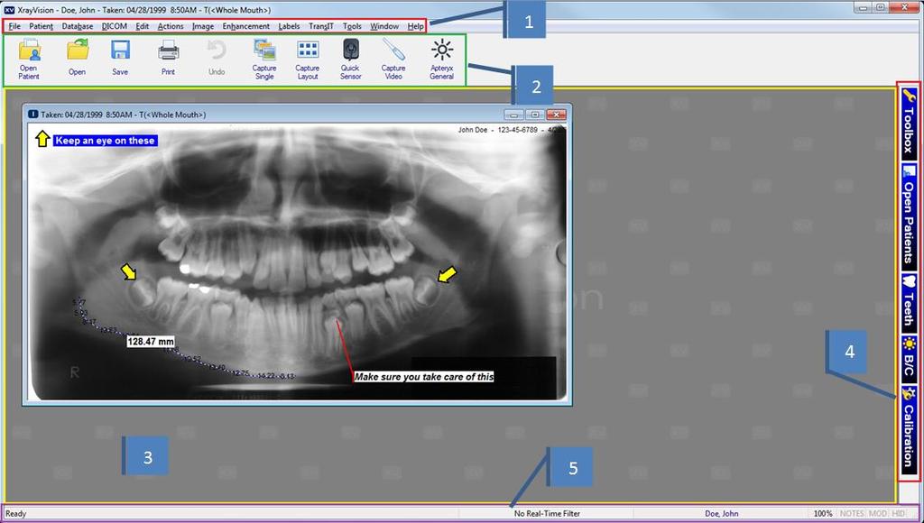 THE USER INTERFACE General Overview XrayVision uses a standard Windows application interface.