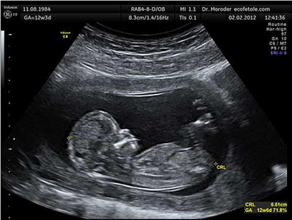 Mediation of perception: obstetric ultrasound 8 Ultrasound is not simply a functional means to