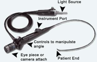gastroscopy, bronchoscopy - Camera - CCD charge-coupled