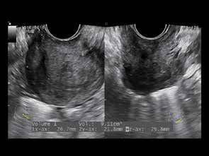 of interest (ROI) on fetal neck's mid-sagittal view.